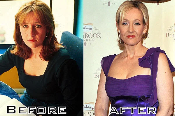 Vibrant Jk Rowling Before And After Plastic Surgery Image for Mobile