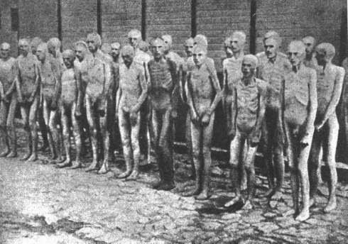 Nazi medical experiments mengele Nazi medical experiments mengele