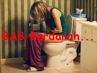 Obat Ampuh Untuk Menghilangkan Benjolan Ambeien Stadium 3 Obat Ampuh Untuk Menghilangkan Benjolan Ambeien Stadium 3