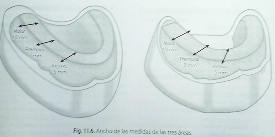 Procedimientos Básicos De laboratorio Dental: Práctica No. 5