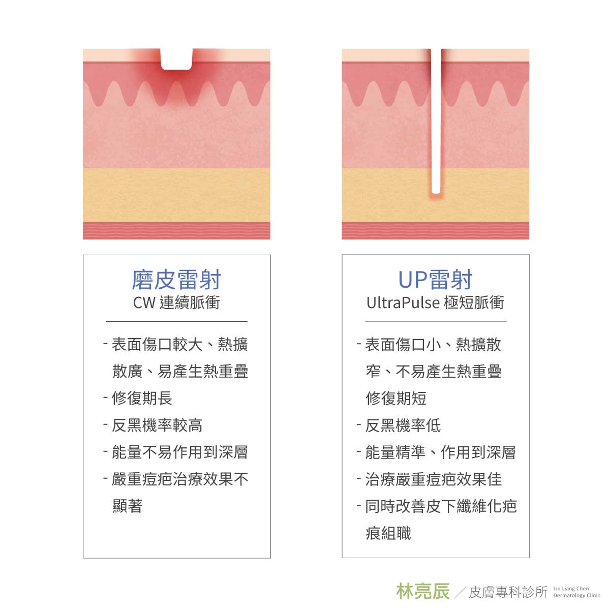 UP雷射UltraPulse痘疤凹疤痘疤淡化凹疤修復凹疤ptt凹洞治療費用淺凹疤蜂巢皮秒凹疤痘疤雷射價錢痘疤雷射推薦痘疤雷射新竹雷射痘疤價位新竹推薦醫師青春痘痘痘果酸煥膚痘痘藥新竹皮膚科林亮辰皮膚專科診所林亮辰醫師新竹推薦醫師皮膚科醫師彩衝光副作用痘疤費用新竹聚左旋乳酸新竹童顏針 UP雷射UltraPulse痘疤凹疤痘疤淡化凹疤修復凹疤ptt凹洞治療費用淺凹疤蜂巢皮秒凹疤痘疤雷射價錢痘疤雷射推薦痘疤雷射新竹雷射痘疤價位新竹推薦醫師青春痘痘痘果酸煥膚痘痘藥新竹皮膚科林亮辰皮膚專科診所林亮辰醫師新竹推薦醫師皮膚科醫師彩衝光副作用痘疤費用新竹聚左旋乳酸新竹童顏針