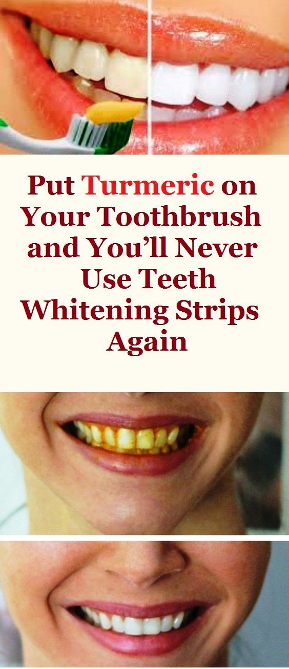 PUT TURMERIC ON YOUR TOOTHBRUSH AND YOU’LL NEVER USE TEETH WHITENING