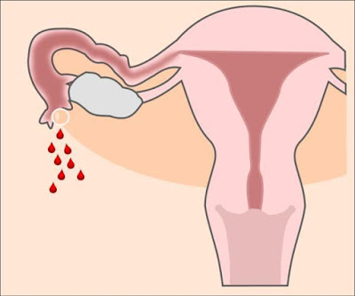 HOW TO FIND IF I AM PREGNANT HOW TO FIND IF I AM PREGNANT
