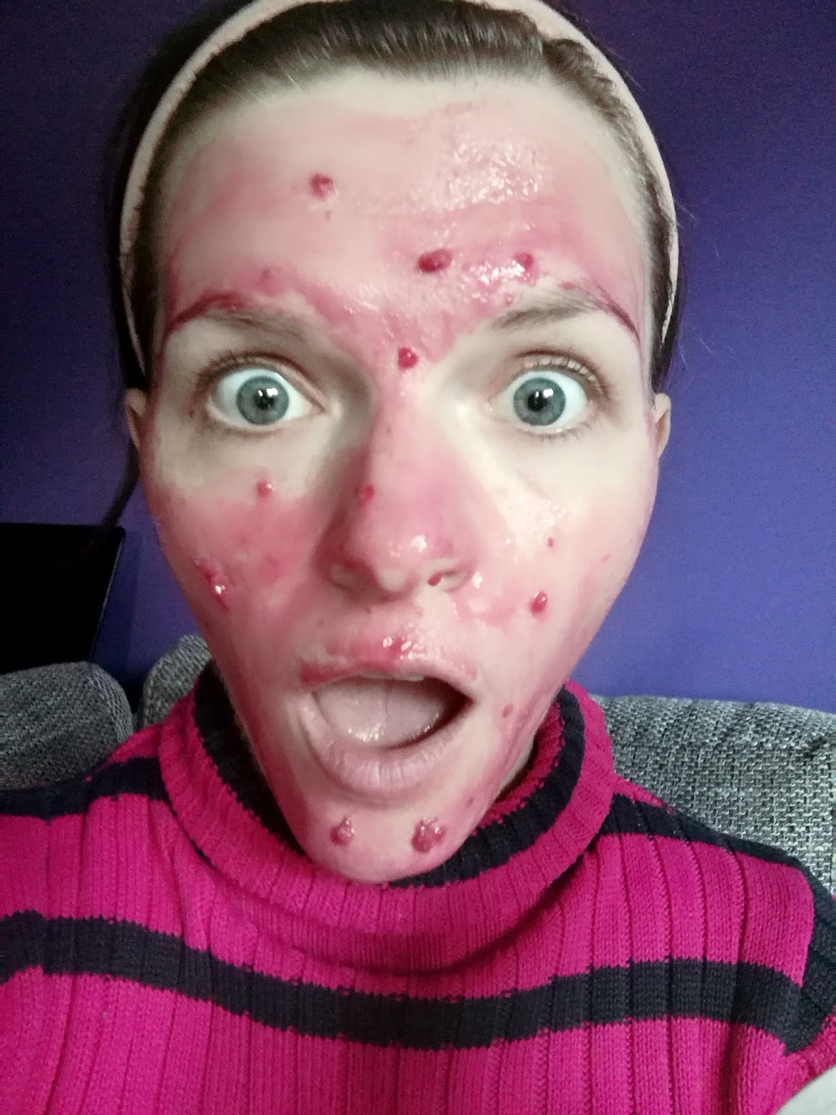 pink-october-diy-raspberry-honey-yoghurt-face-mask-selfie-1
