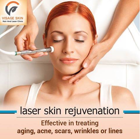 prepare laser yourself hair treatments clinic visage skin