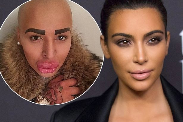 Freakish Male Version of Kim Kardashian wants even More surgery!