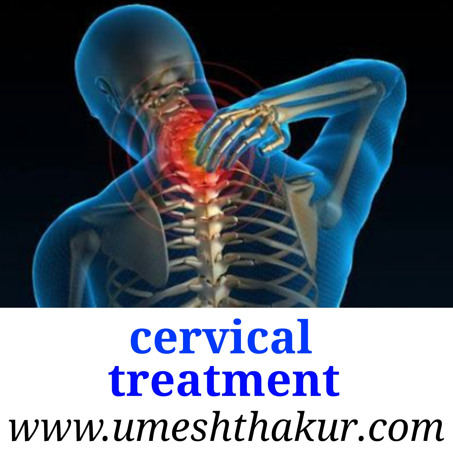 Cervical Neck Pain, Cervical Symptoms, Causes, और सर्वाइकल का रामबाण