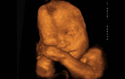 25 haftalık gebelik görüntüsü