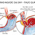 Viêm đường hô hấp bắt nguồn từ bệnh trào ngược dạ dày