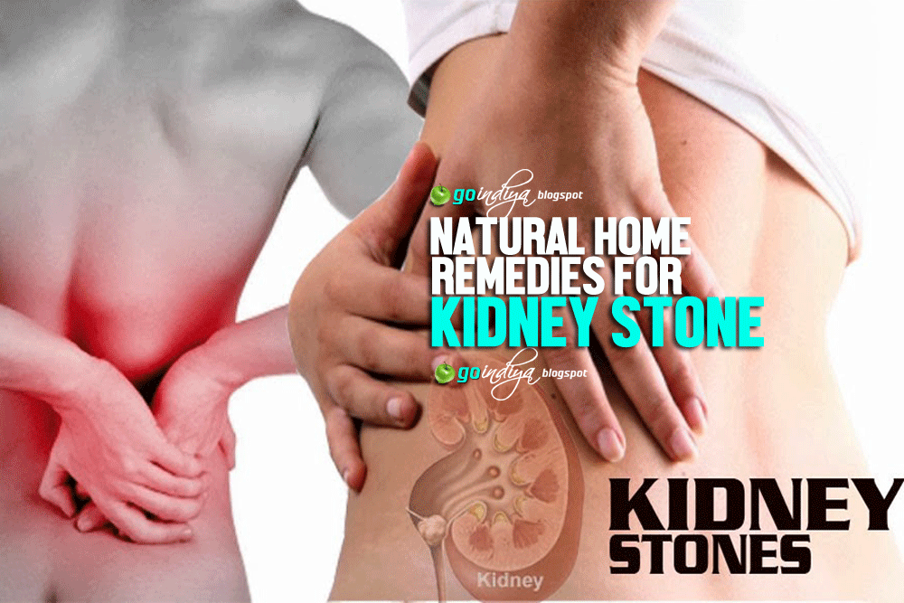 Kidney stone & pain natural home remedies to remove kidney stone