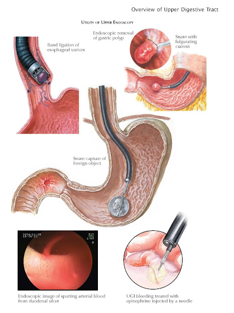 Endoscopic Evaluation of the Upper Digestive Tract