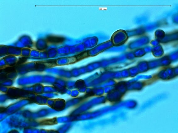 Fun With Microbiology Whats Buggin You Aureobasidium Pullans