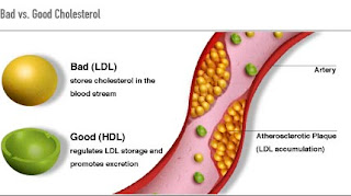 What-is-Good-Cholesterol-&-Bad-Cholesterol