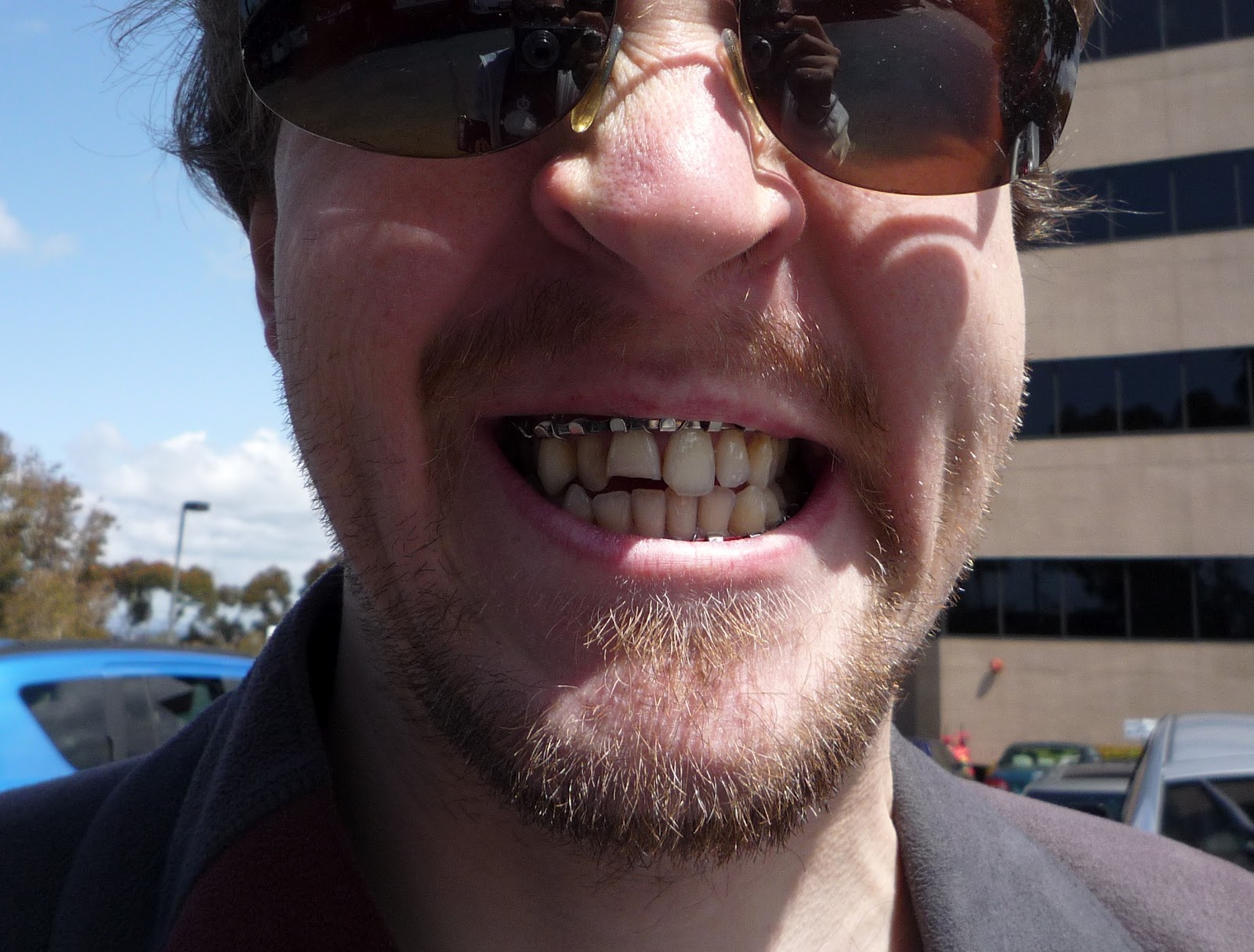 Will it Blend? Goodbye Arch Bars!