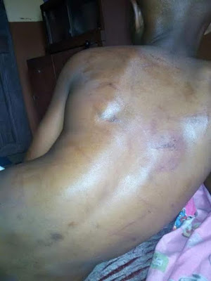 4 Photos: 11-year-old boy brutally assaulted and thrown out onto the streets by stepmother in Lagos