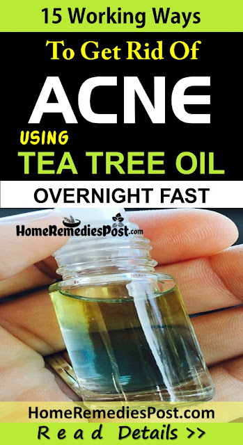 Tea Tree Oil For Acne, Tea Tree Oil Acne, How To Use Tea Tree Oil For Acne, Is Tea Tree Oil Good For Acne, Tea Tree Oil And Acne, How To Get Rid Of Acne With Tea Tree Oil, 