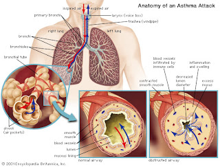 Pathway Asthma Bronkial