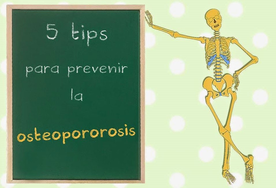 5 tips para prevenir la osteoporosis