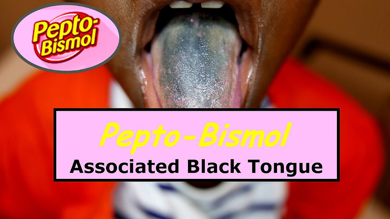 Does Pepto Bismol Make Your Poop Black Black Choices