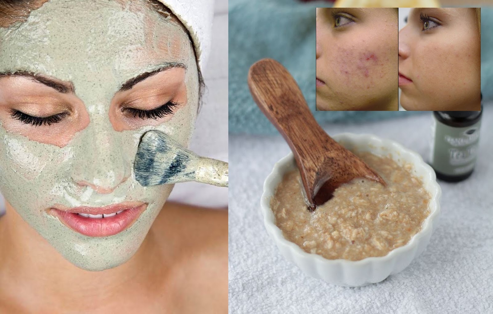 Mascarilla de patata para la piel grasa Mascarilla de patata para la piel grasa