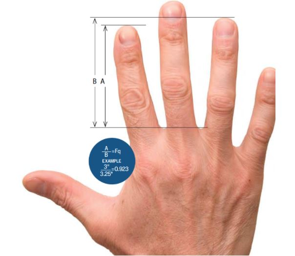 Rhonda's Escape Feminine Differential Digit Ratio