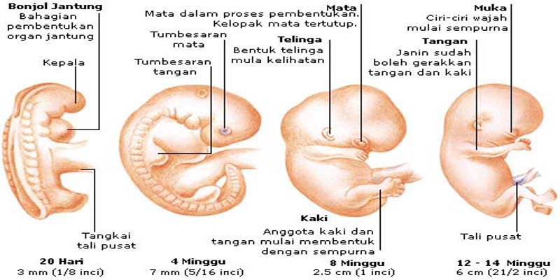Bahaya Gusi Bernanah Mulai Dari Nyeri Biasa Hingga Sakit Jantung Dan Infeksi Otak