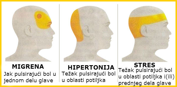 glavobolje, hipertenzije, stres