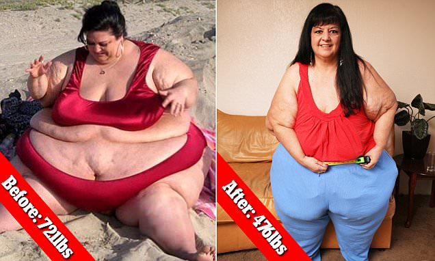 Karena Putus, Wanita Ini Berat Badannya Turun Hingga 100 Kg