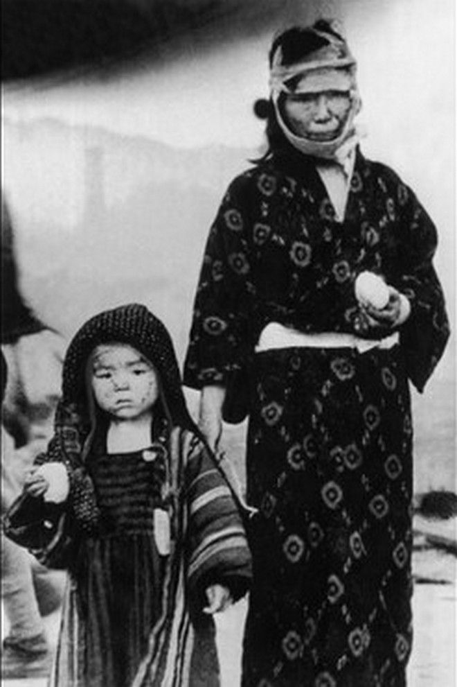 20 Shocking Pictures Of Hiroshima, The First City In History To Be Destroyed By An Atomic Bomb - 70,000 people died instantly in Nagasaki. Photo of a survivor with her child