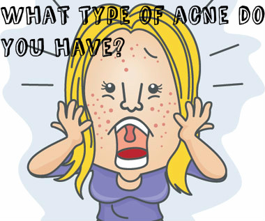 What type of acne do you have?