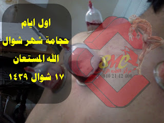 الخليل للحجامه والطب البديل Publications Facebook