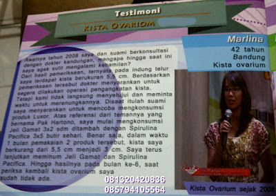 Penyebab dan Jenis Kista Ovarium