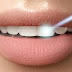TEETH WHITENING: PRICES AND TREATMENTS