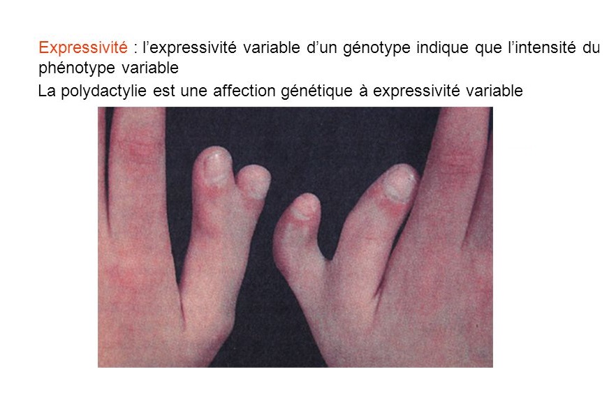 Transmission de maladie autosomique dominante Bio faculté
