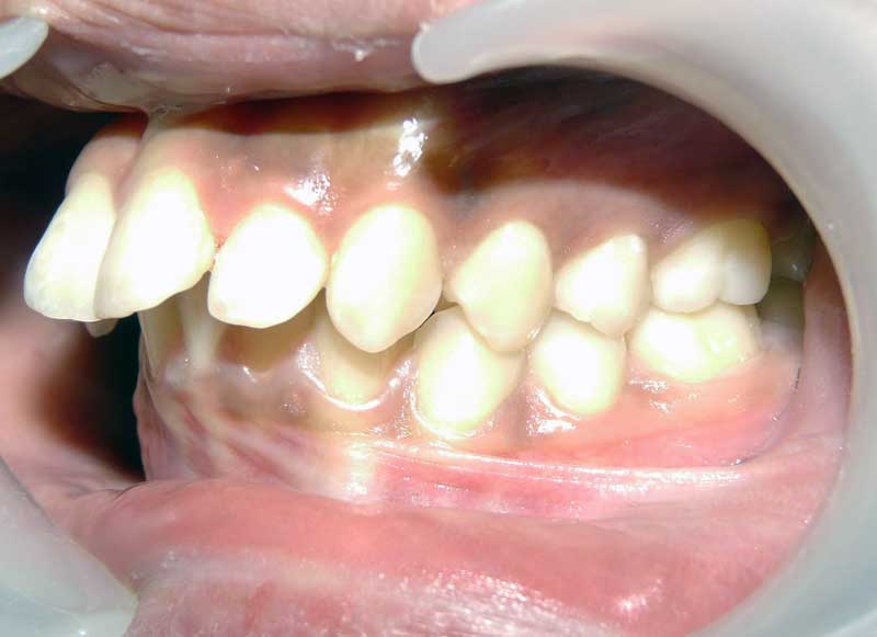 Expérience de Traitement Orthodontique et Chirurgie Maxillo Faciale Les traitements