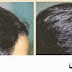 وصفة مغربية مجربة لتساقط الشعر