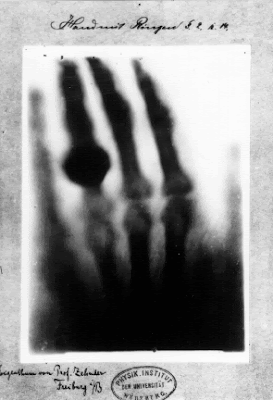 Photo Wife Taken Years Changed Lives Xray Born