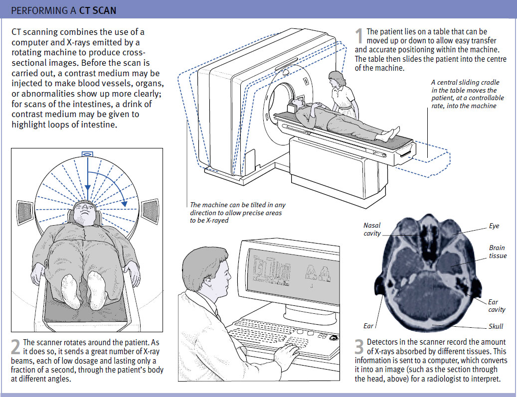 CT scanning Nursing