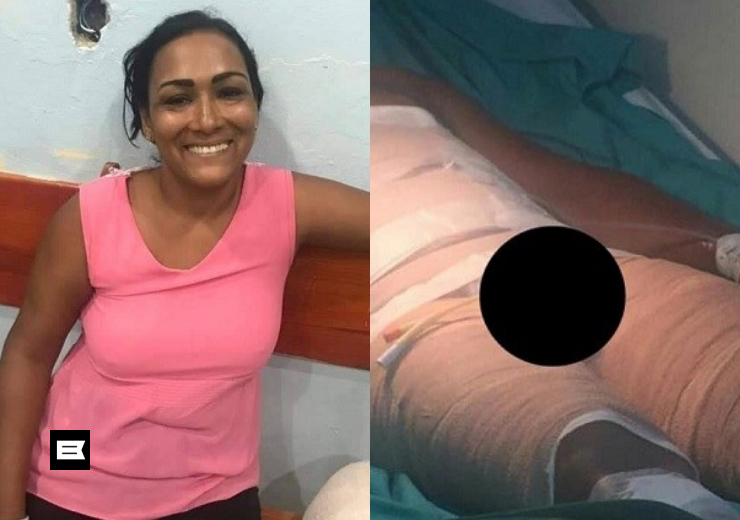 Video: Le quemó el bimbolo a expareja con agua caliente en Santiago Video: Le quemó el bimbolo a expareja con agua caliente en Santiago