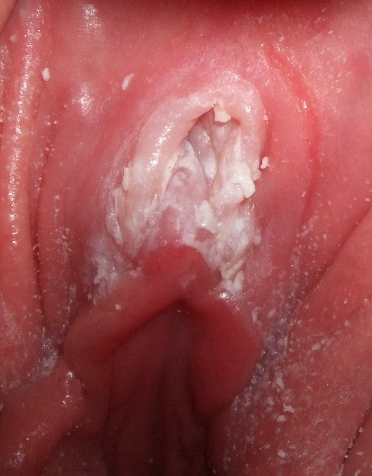 The vulva vagina