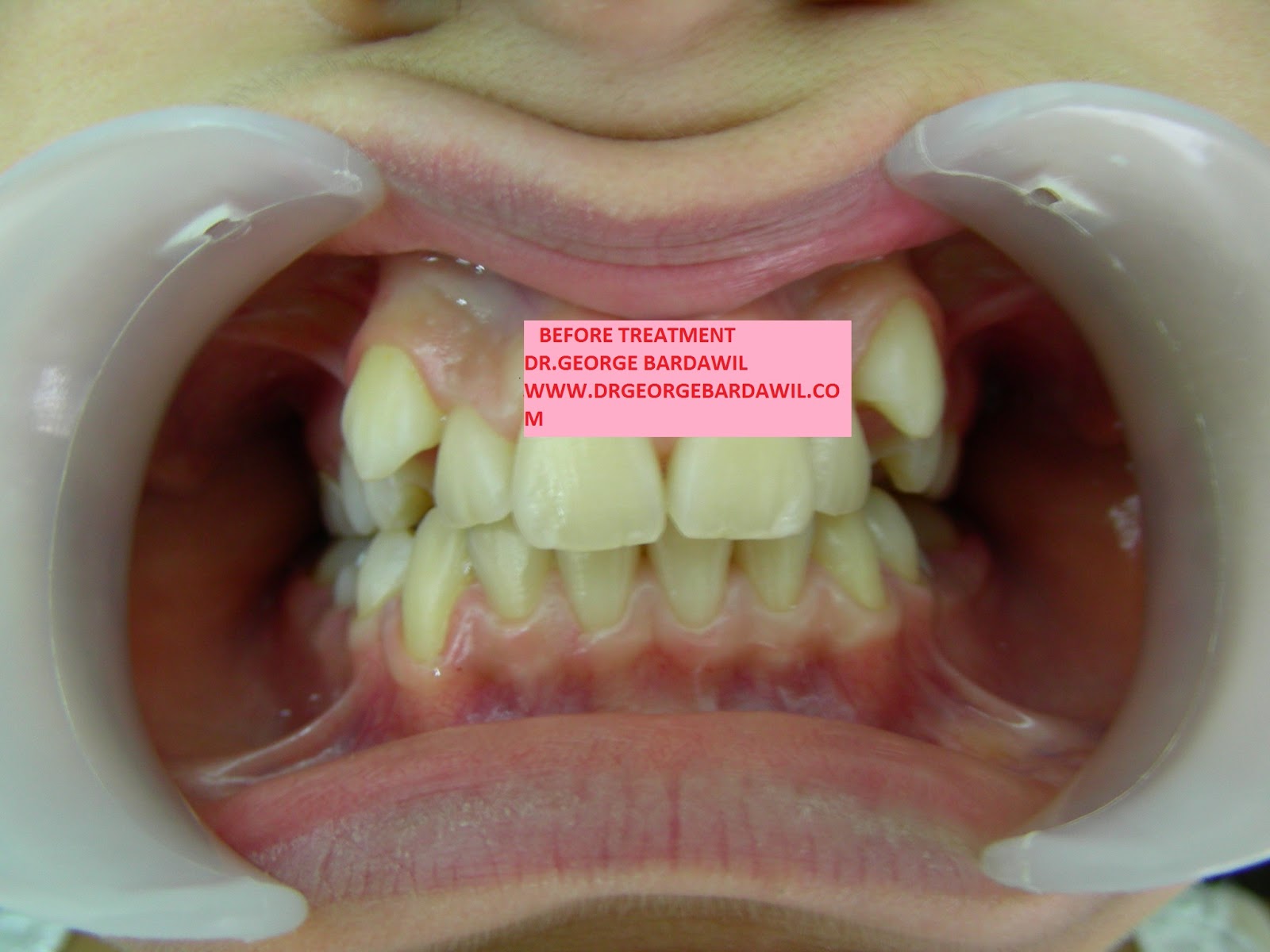 E. BardawilOrthodontistInvisalign Diamond level Smile