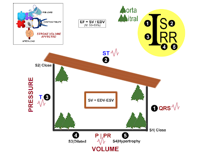 Medical MindMaps for USMLE Step 1: Cardiac Cycle