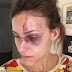 'You think you're the man but you're not': College girlfriend victim of 'drugged up' US heir releases shocking audio of the 'beating' as his billionaire family announces they will SUE her for releasing photos and video of the 'abuse'