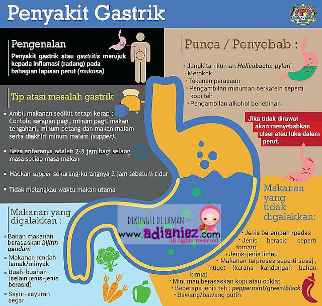 Penyakit Gastrik : Tips Mengatasi & Makanan Yang Digalakkan