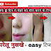 २ दिन में गोरा होने का तरीका 2 Din me Gora hone ka tarika