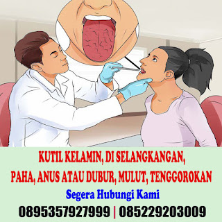 4 Jenis Obat Kutil Kelamin Dokter Terpercaya Alami yang Bisa Anda Coba Teruji 3/8 Hari Langsung Sembuh 4 Jenis Obat Kutil Kelamin Dokter Terpercaya Alami yang Bisa Anda Coba Teruji 3/8 Hari Langsung Sembuh