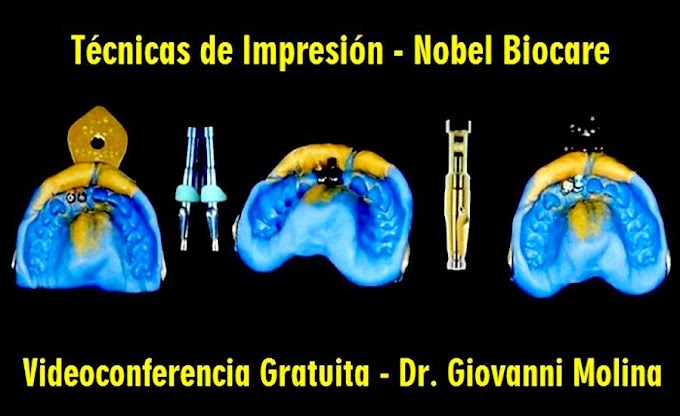 VIDEOCONFERENCIA: Técnicas de Impresión - Nobel Biocare - Dr. Giovanni Molina