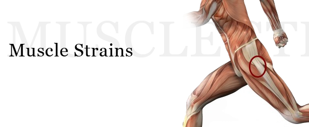 Muscle Strain muscle-strain