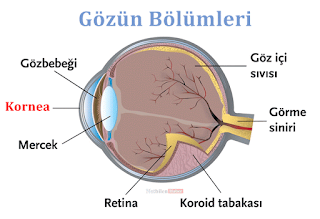 kornea nakli nedir