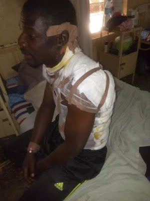 2 Photos: Angry wife pour boiling water on husband in Plateau State for marrying second wife